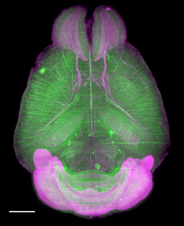 CUBIC组织透明化试剂                              具有单细胞分辨率的全脑/全身成像