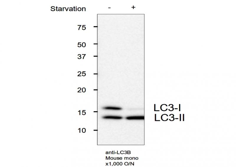 抗 LC3 单克隆抗体（克隆号：LC3.NO6） Anti LC3 (Clone: LC3.No.6) monoclonal antibody