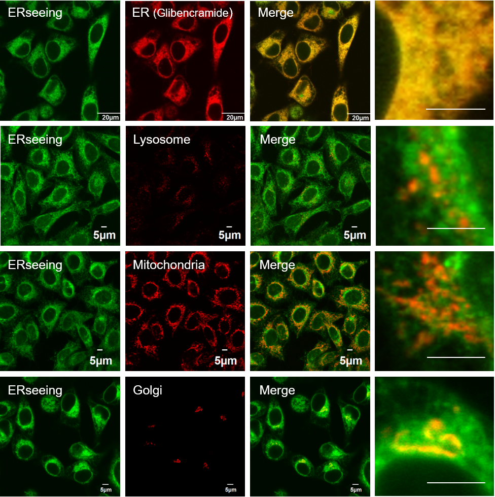 ERseeing ＜Endoplasmic Reticulum Green＞ 对活细胞影响少，适于长时间成像的ER染色试剂