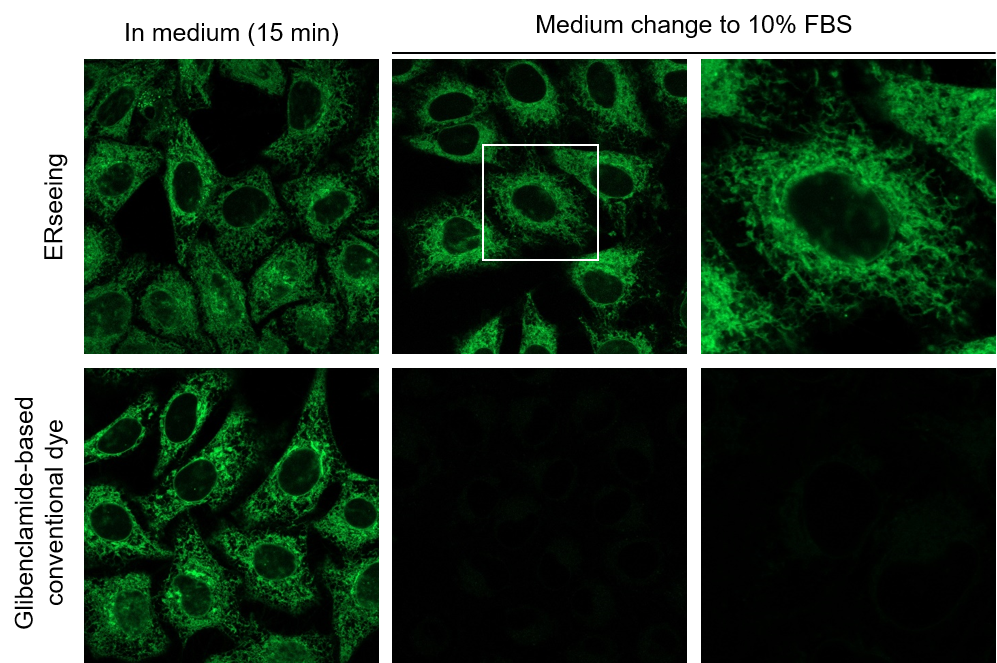 ERseeing ＜Endoplasmic Reticulum Green＞ 对活细胞影响少，适于长时间成像的ER染色试剂